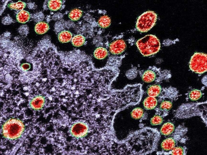 Viral Intrusion